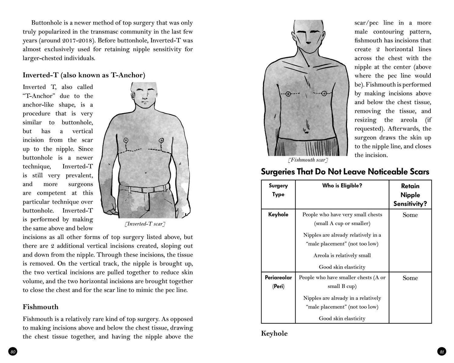Transmasculine Guide to Physical Transition: For Trans, NB +